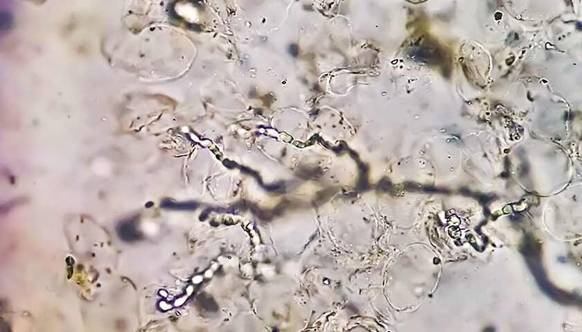 Les champignons au microscope, responsables du développement de mycoses des pieds